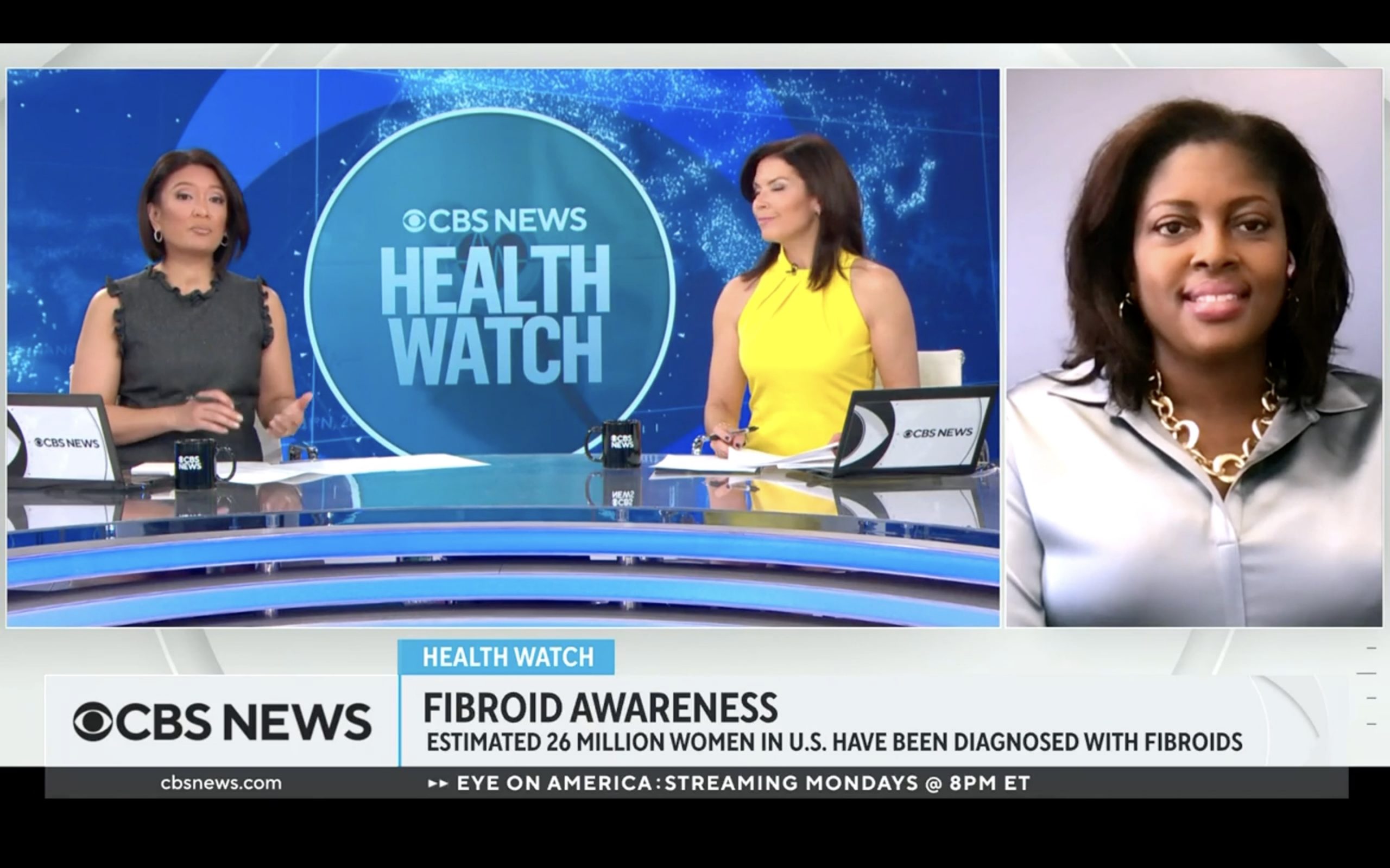 Fibroid Foundation Founder Sateria Venable on CBS News helping draw attention to fibroid health