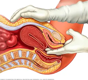 A gloved hand performs a pelvic examination